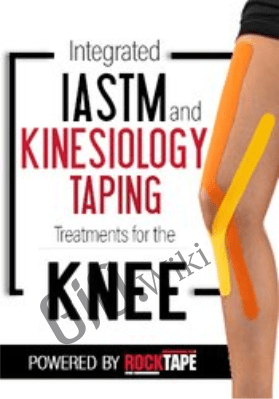 Integrated IASTM and Kinesiology Taping Treatments for the Knee - Shante Cofield