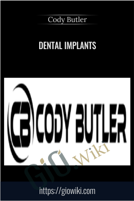 Dental Implants – Cody Butler