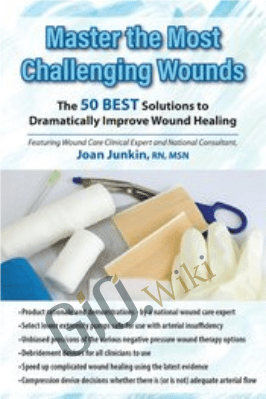 Master the Most Challenging Wounds: The 50 BEST Solutions to Dramatically Improve Wound Healing - Joan Junkin