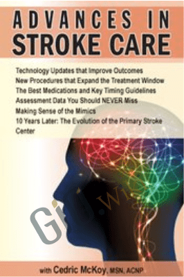 Advances in Stroke Care - Cedric McKoy