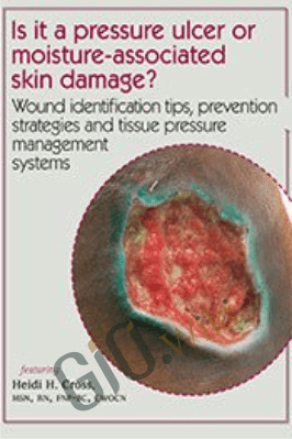 Is it a pressure ulcer or moisture-associated skin damage? Wound identification tips, prevention strategies and tissue pressure management systems - Heidi Huddleston Cross