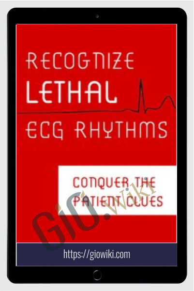 Recognize Lethal ECG Rhythms: Conquer the Patient Clues - Robin Gilbert